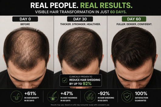 Balestina Microneedle Infusion Hair Regrowth System